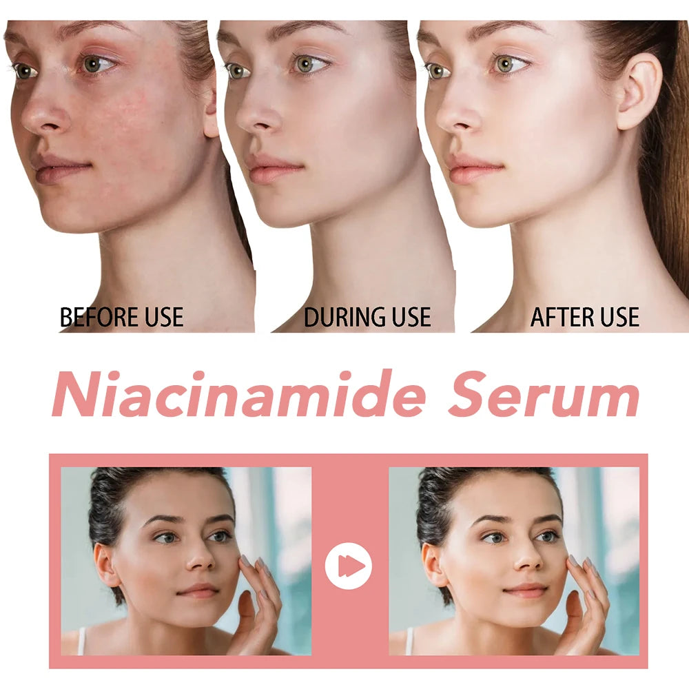 Sérum Niacinamide – Éclat & Correction des Taches